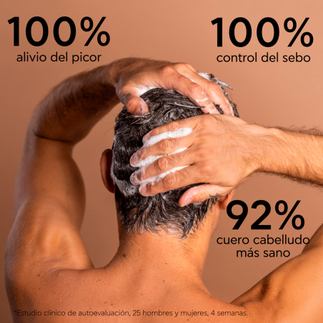 Champú Anticaspa Grasa