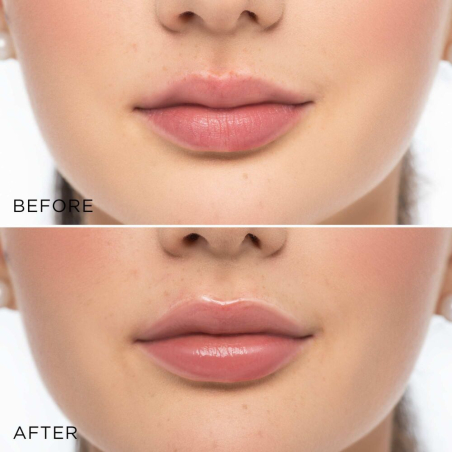 Glossy Lip Volumizer