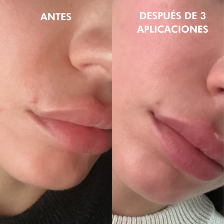 SOS Correction Stick
