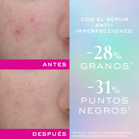Zinc Power Sérum Anti-Imperfecciones