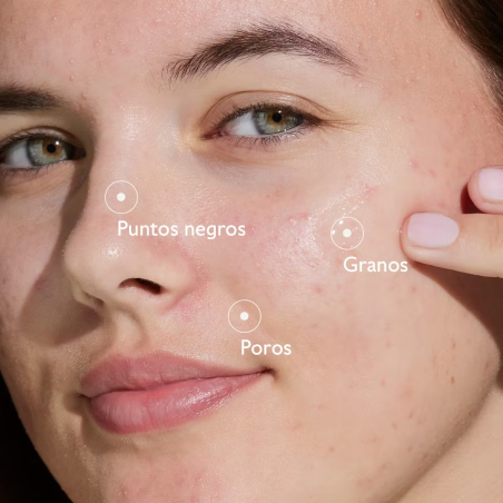 Vinopure Sérum con Acido Salicílico Anti-imperfecciones