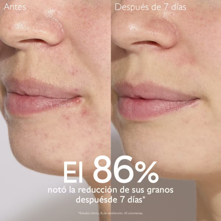 Vinopure Sérum con Acido Salicílico Anti-imperfecciones