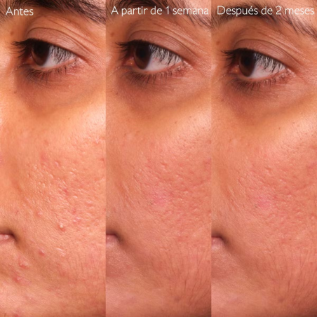 Vinopure Sérum con Acido Salicílico Anti-imperfecciones