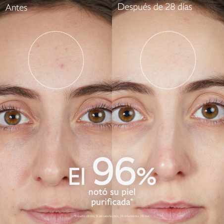 Vinopure Gelatina Limpiadora Purificante con Acido Salicílico