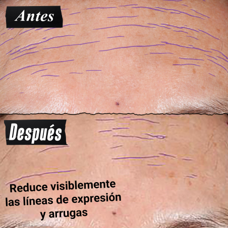 Retinol Skin-Renewing Daily Micro-Dose Serum