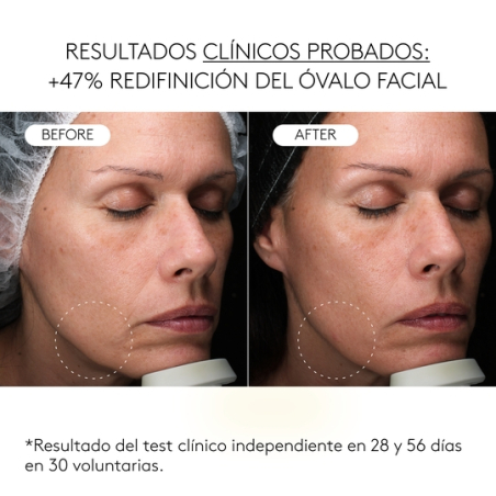 Clinical Exosomas Serúm