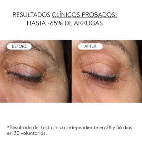 Clinical Exosomas Serúm