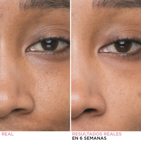 BYE BYE PORES SERUM 30 ML