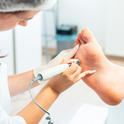 PIES TRATAMIENTO CALLUSPEELING