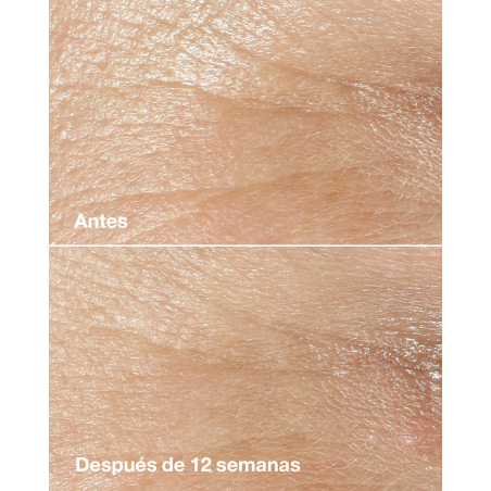 CREMA ANTIEDAD SMART CLINICAL REPAIR WRINKLE CORRECTING CREAM EDICIÓN LIMITADA