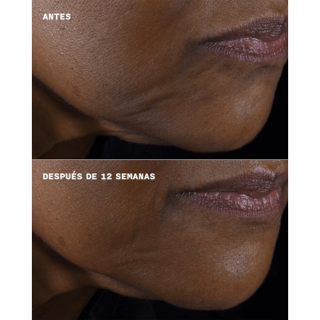 SMART CLINICAL REPAIR LIFTING FACE + NECK CREAM