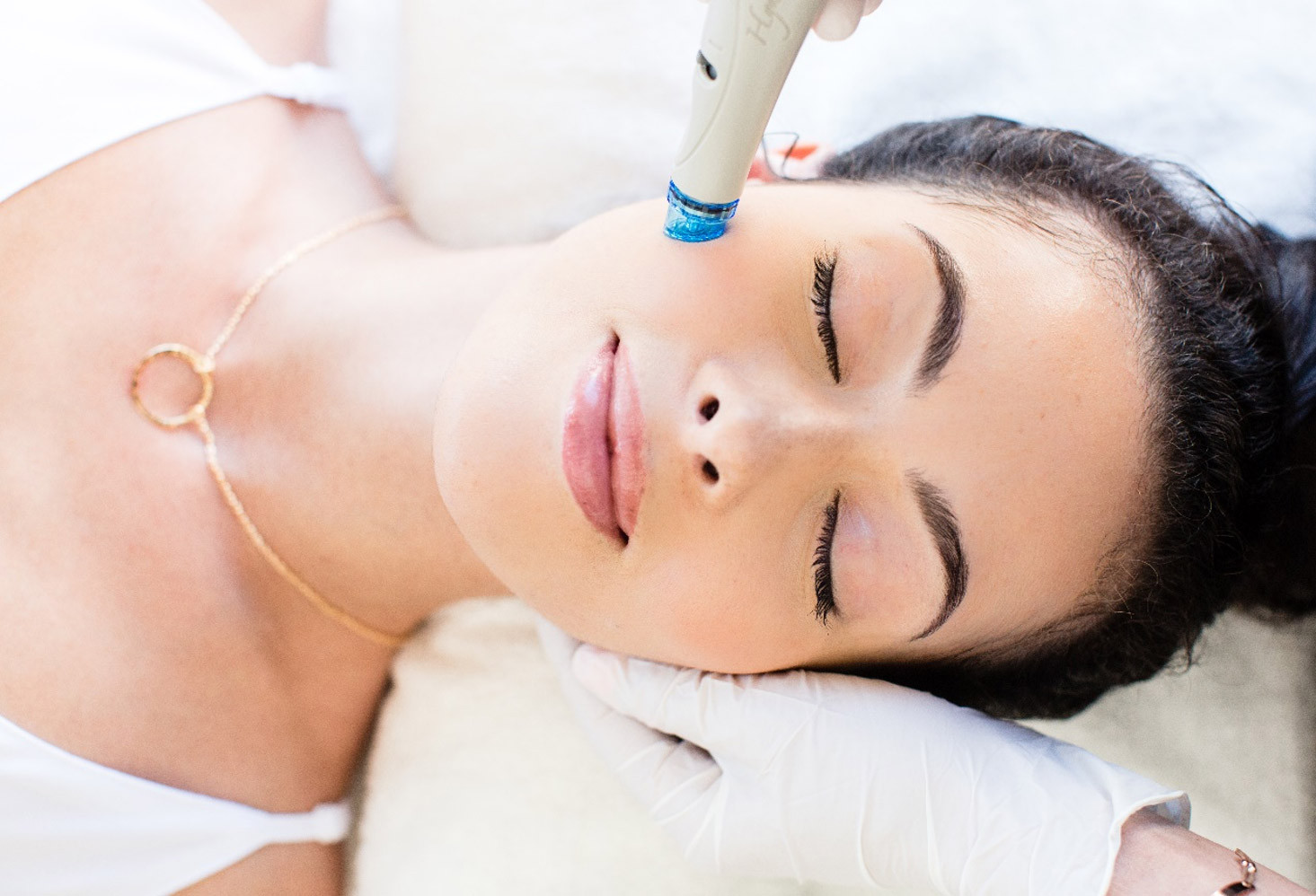 tratamiento hydrafacial